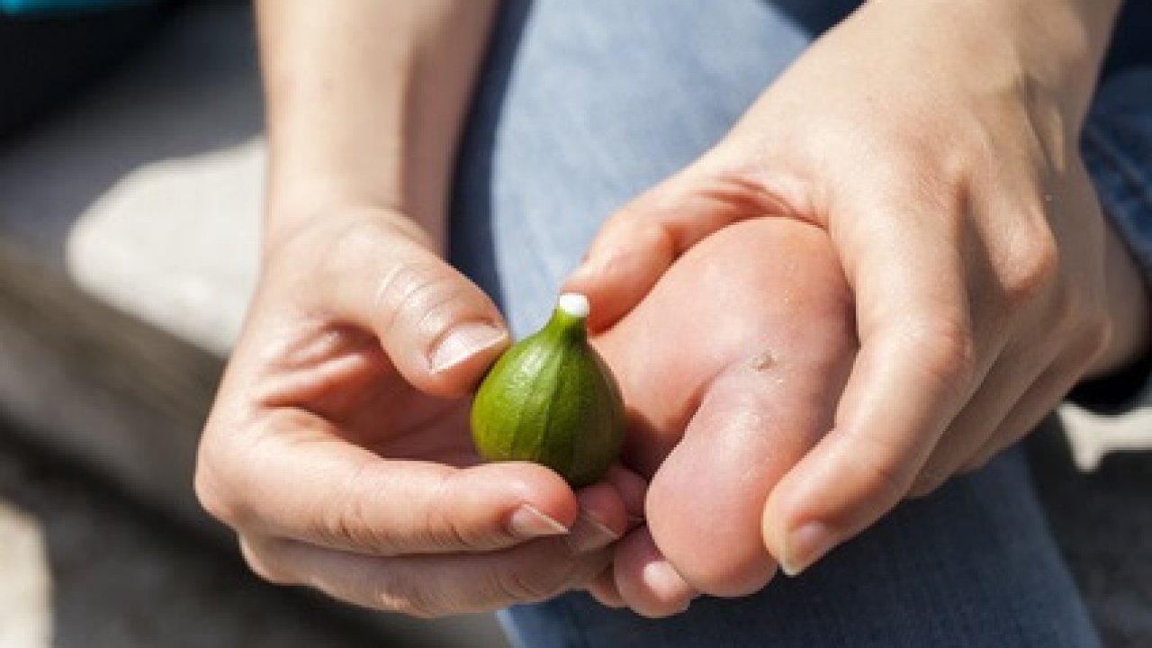 quitar Verrugas | Trucosnaturales.com