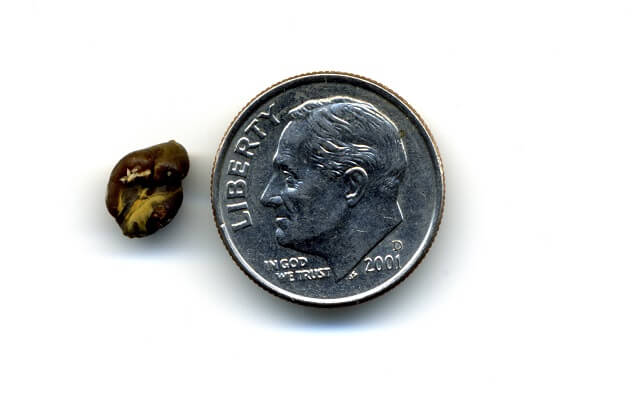 piedra de rinon junto a un dolar